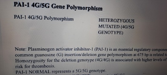 ERA EMMA ALICE testing thread 9