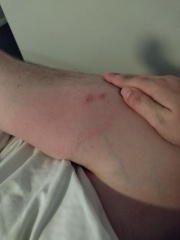 What bit DP? (Pics)