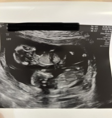 February 2024 Babies 👶 (thread 3)
