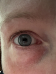 Wrinkles wrinkles wrinkles at 39 help!