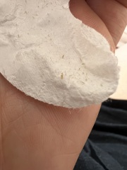 Nose pore strip pics
