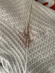 Bleeding at 8 weeks pregnant