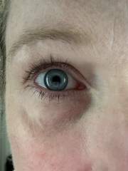 Wrinkles wrinkles wrinkles at 39 help!