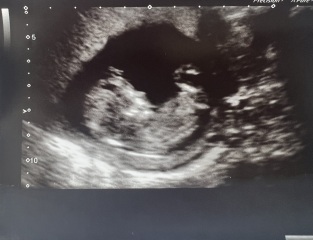 Nub theory guess for baby three