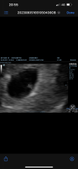 Successful scans at 6 weeks?