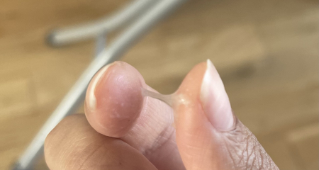 9DPO BFN girlies?