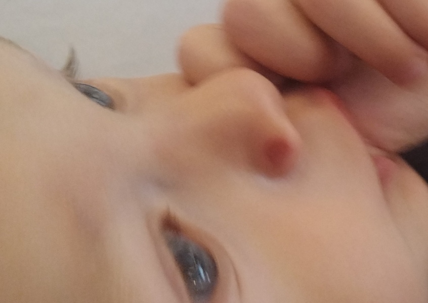 Spot on 1 year old nose