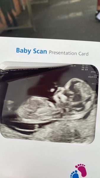 Is my scan normal ?