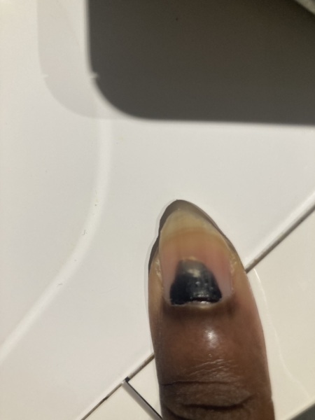 Why is my thumbnail turning black?