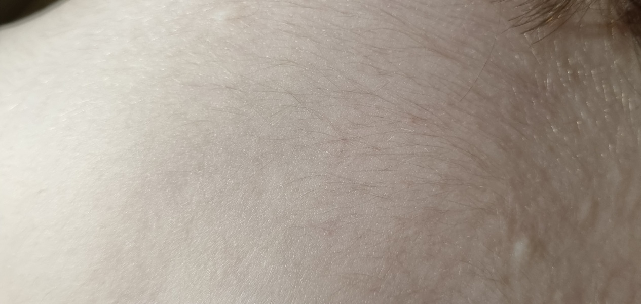 What are these lumps on DDs back?