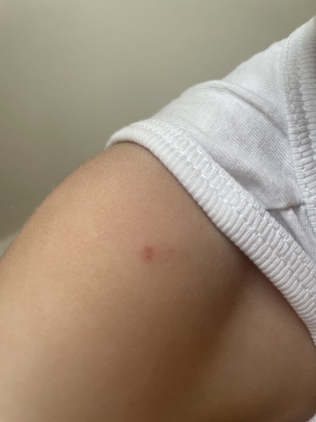 Sons friend biting - advice please!