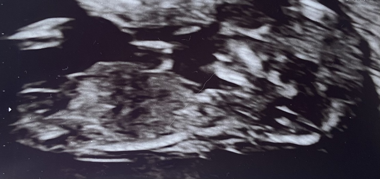 March 2024 continued!