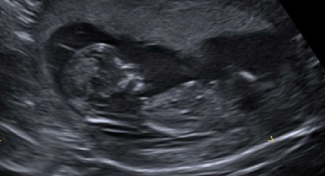 20 week gender guesses!