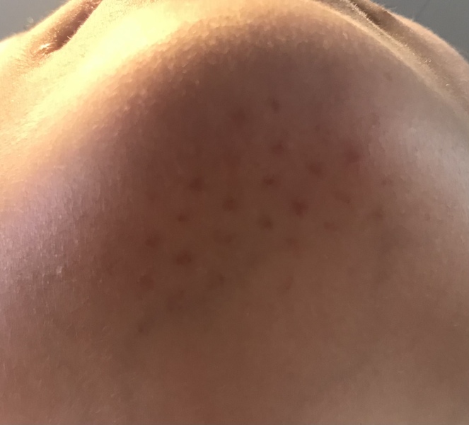 What’s occurring with DD’s chin?