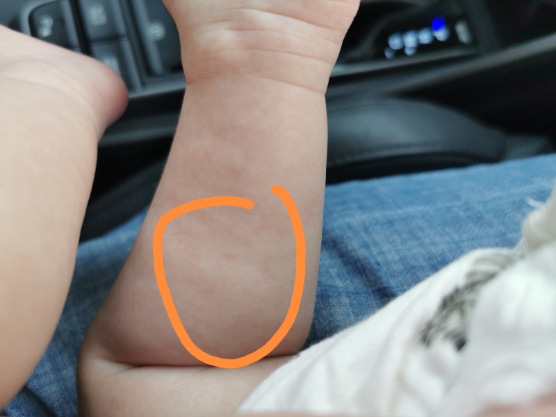 What are these spots/rash?