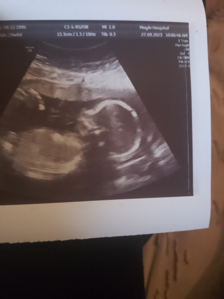 Boy or girl?