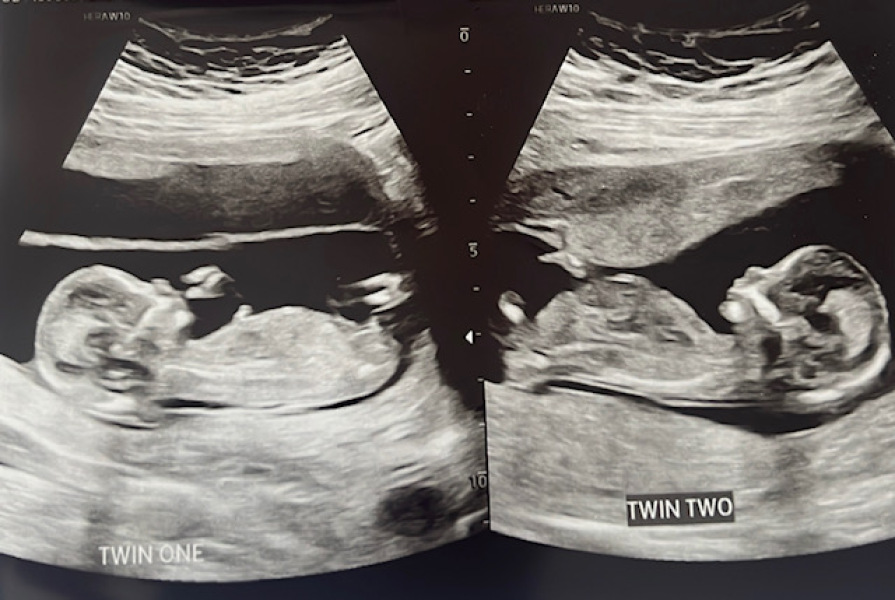 March 2024 continued!