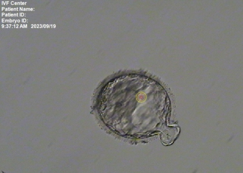 Azoospermia support, stories and timelines