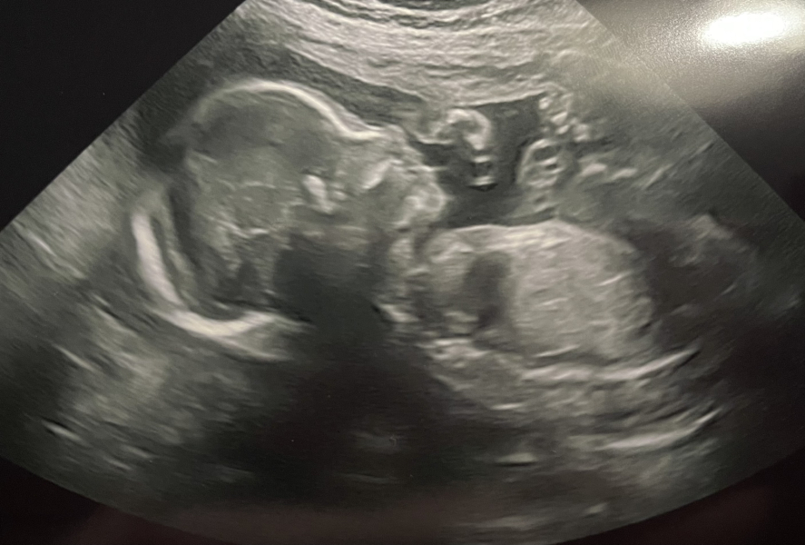Due January 2024, Part 7!