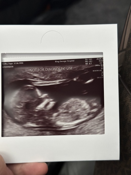 Going down a rabbit hole with nub theory (yes I know I am crazy) - Is this definitely a boy!