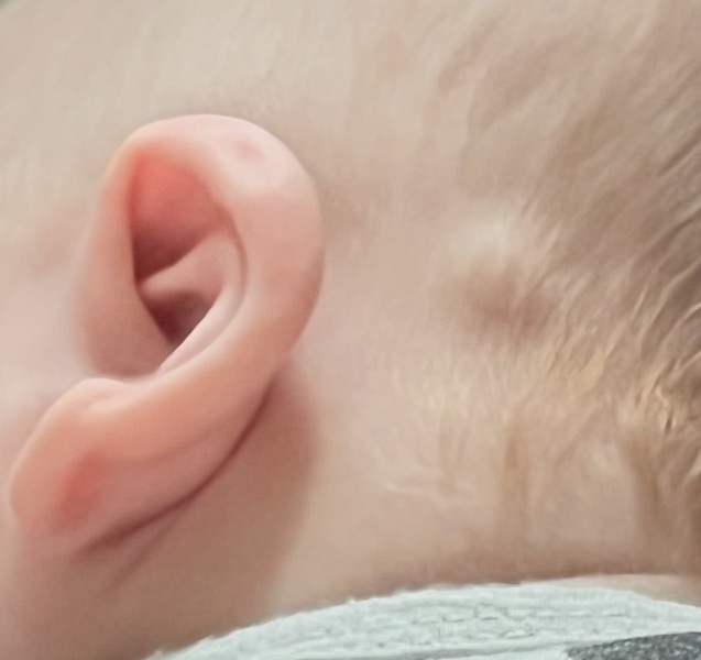 Can you guys see your infants lymph nodes?