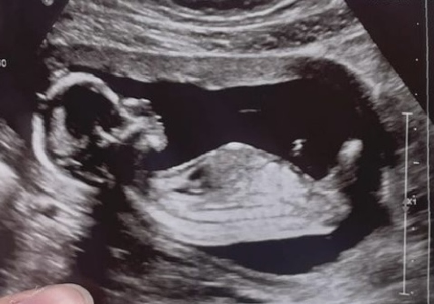 NUB THEORY GUESSES PLEASE?