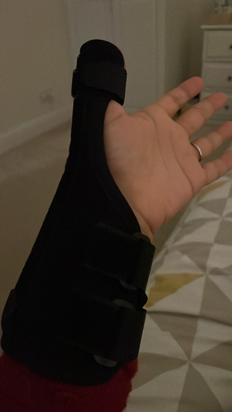 Mum thumb/mum wrist (de quervain tendonitis)