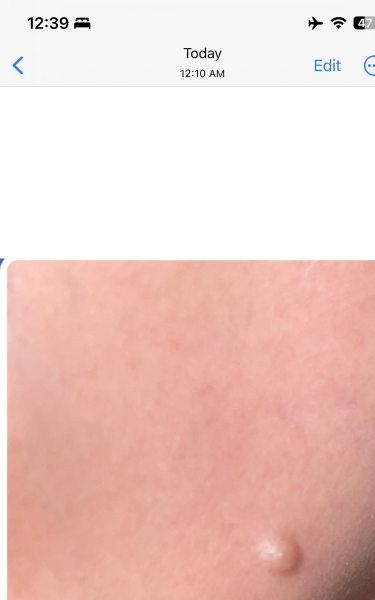 Beware picture attached .. Cyst or something more serious