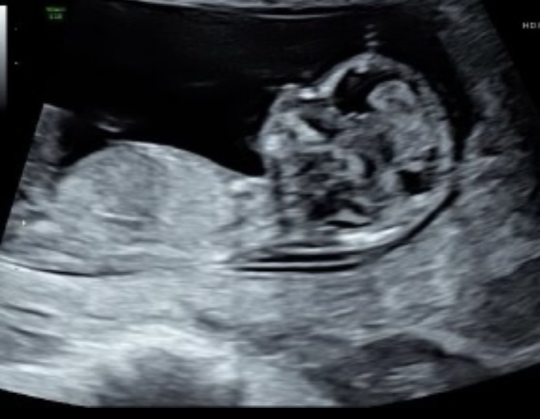 Gender guesses please 😊