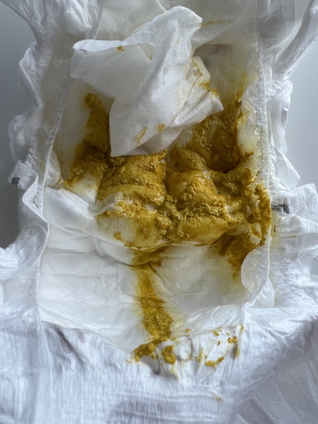 Baby has had diarrhoea for over a week