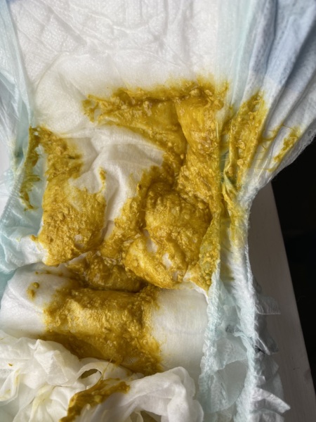 Dirty nappies