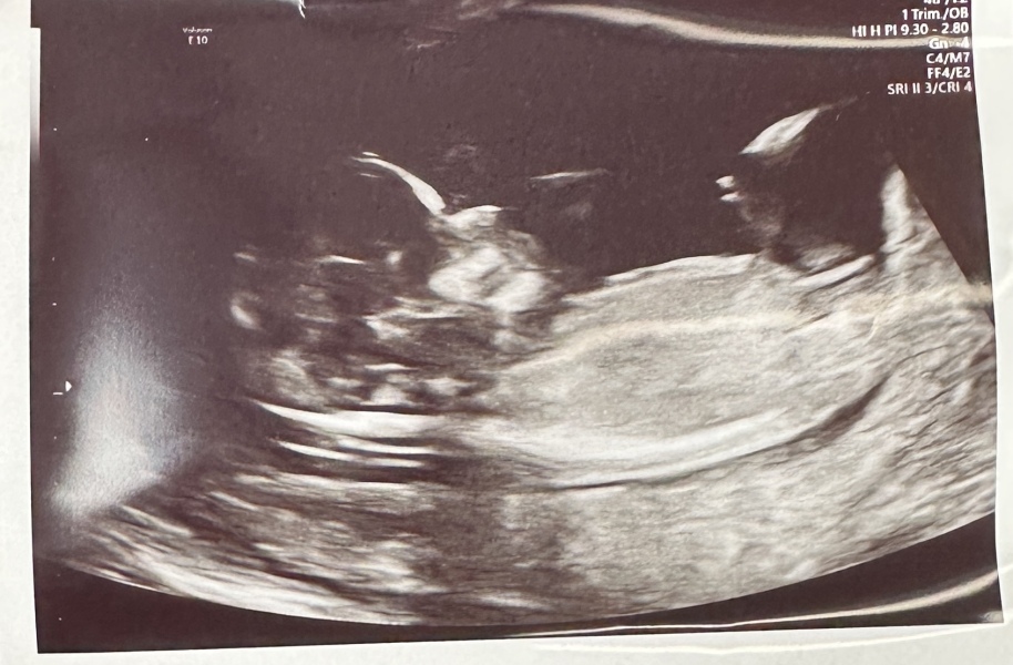 Gender guesses 😍 (nub/skull theory)