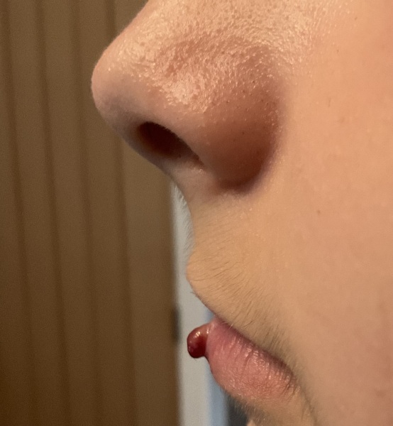 To take my son to the doctors for a potential ‘cold sore’ *image attached*