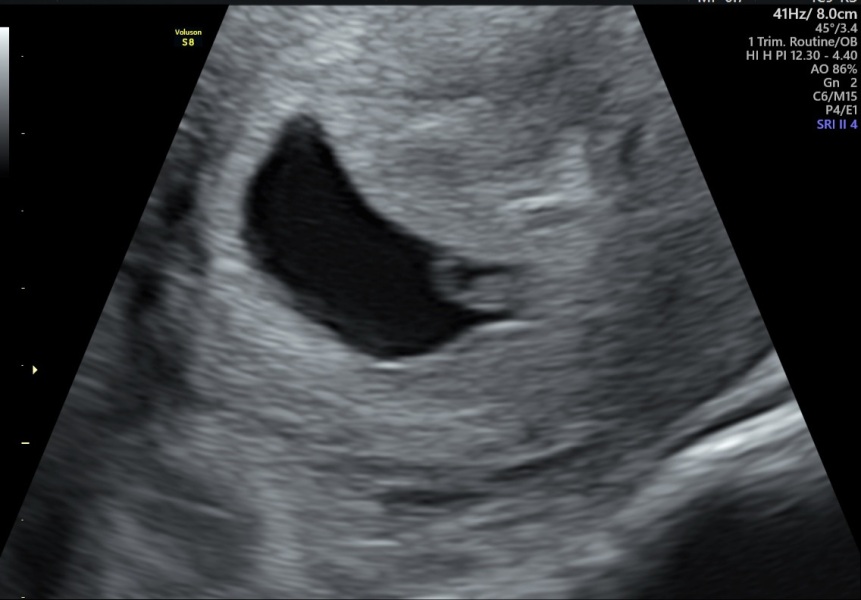 Due May 2024?