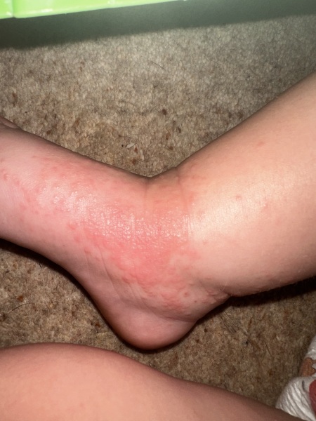 Strange rash…