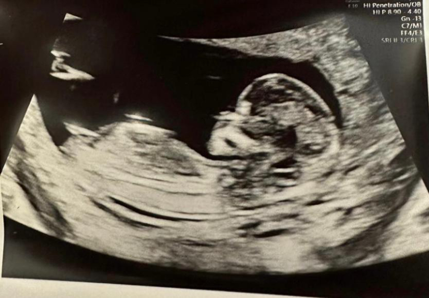 Boy or Girl ?