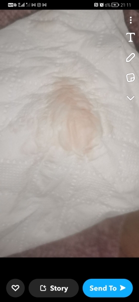 Is this implantation?