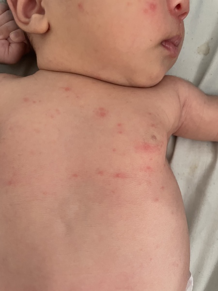 Baby spots in chest