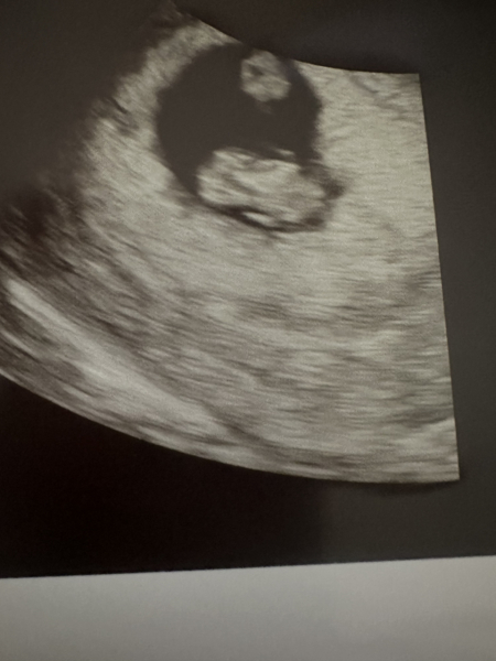 Anyone due in April 2024? #2