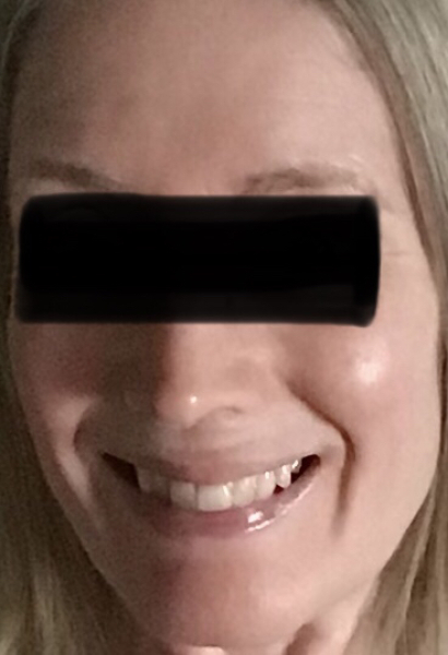 SPF-how many use it correctly?