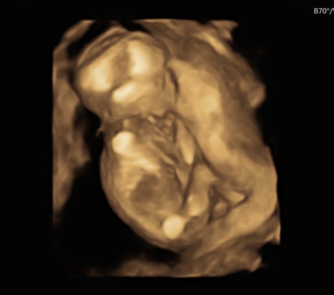 Feb 2024 thread 4