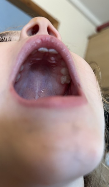 Does anyone know what this is in my child's mouth (pic)