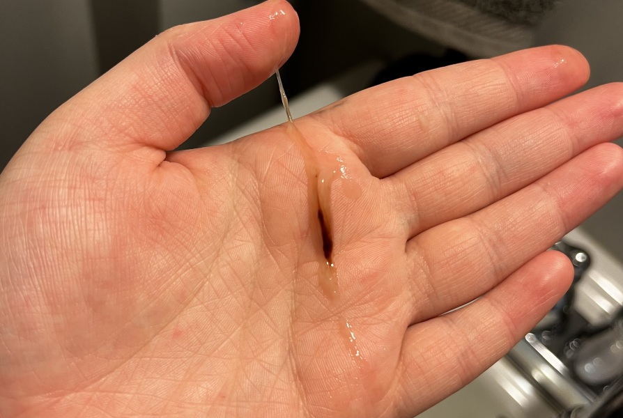 Implantation bleeding?