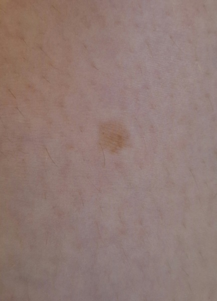 What is this?