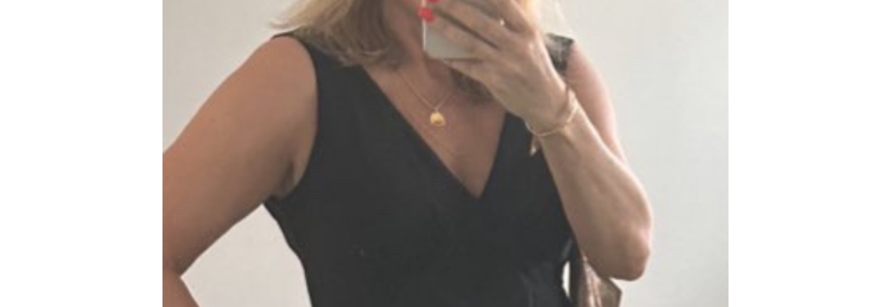 We’ve had breast reductions. Ask us anything.