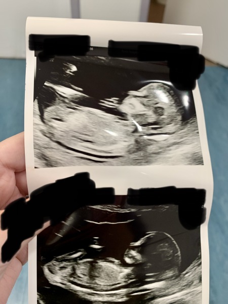 Boy or girl predictions