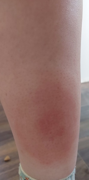 What are these