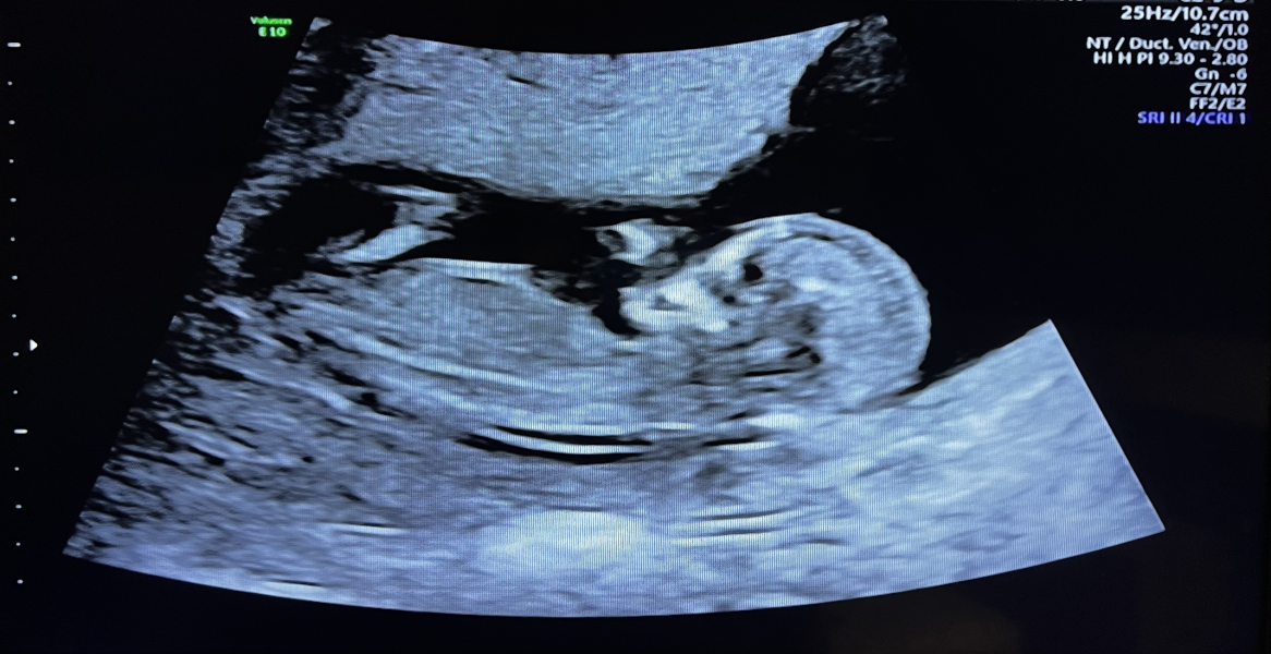 March 2024 continued!