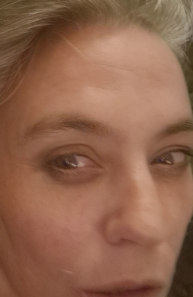 37 forehead worries