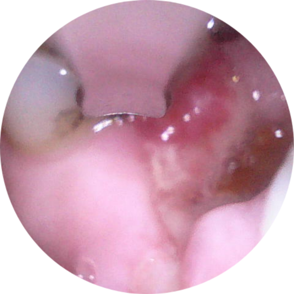 Any Dentists willing to look at a yucky photo. Warning seriously nasty photo